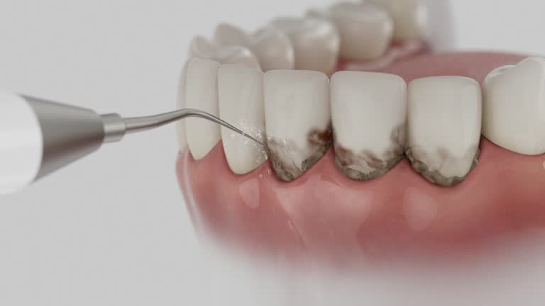 Reliable Tooth Extraction contractor in Bentonville, AR by Smile Center Dentistry